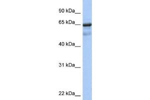 WB Suggested Anti-PCK1 Antibody Titration:  0. (PCK1 anticorps  (N-Term))