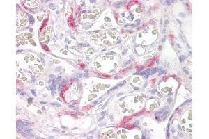 Anti-PHLDA2 antibody IHC of human placenta. (PHLDA2 anticorps  (AA 139-152))