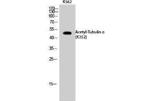 Western Blotting (WB) image for anti-alpha Tubulin (TUBA1) (acLys352) antibody (ABIN6285483) (alpha Tubulin anticorps  (acLys352))
