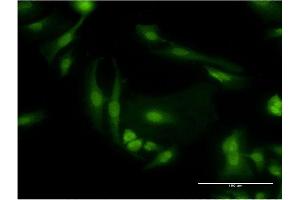 Immunofluorescence of monoclonal antibody to PDE6D on HeLa cell. (PDE6D anticorps  (AA 1-150))