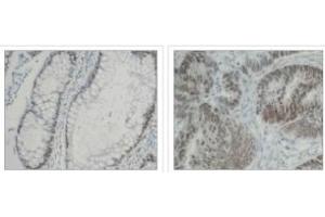 Immunohistochemistry (IHC) image for anti-Heterogeneous Nuclear Ribonucleoprotein K (HNRNPK) (C-Term) antibody (ABIN264512)