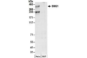 Western Blotting (WB) image for anti-pi-3-Kinase-Related Kinase SMG-1 (SMG1) (AA 1625-1675) antibody (ABIN7452857)