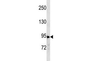 Anti-STAT3 antibody western blot analysis in A431 lysate
