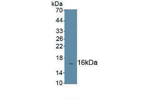 Detection of Recombinant CCR7, Mouse using Polyclonal Antibody to Chemokine C-C-Motif Receptor 7 (CCR7) (CCR7 anticorps  (AA 290-378))