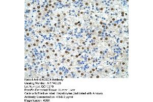 Rabbit Anti-EXOSC4 Antibody  Paraffin Embedded Tissue: Human Liver Cellular Data: Hepatocytes Antibody Concentration: 4. (EXOSC4 anticorps  (N-Term))