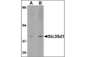 Western blot analysis of Slc35D1 inA-20 lysate with Slc35D1 antibody at (A) 1 and (B) 2 µg/ml. (SLC35D1 anticorps  (N-Term))