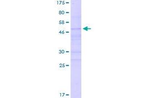 Image no. 1 for Neurogenin 2 (NEUROG2) (AA 1-272) protein (GST tag) (ABIN1312424)