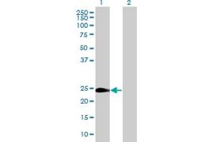 Western Blot analysis of WISP2 expression in transfected 293T cell line by WISP2 MaxPab polyclonal antibody. (WISP2 anticorps  (AA 1-250))
