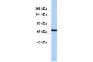 WB Suggested Anti-PCDH15 Antibody Titration:  0.