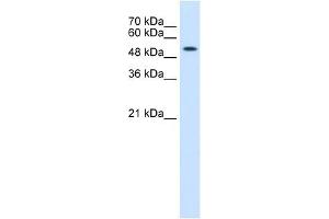 Cytokeratin 8 antibody used at 0. (KRT8 anticorps  (N-Term))