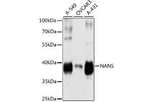 Western blot analysis of extracts of various cell lines, using NANS antibody (ABIN6291679) at 1:3000 dilution. (NANS anticorps)
