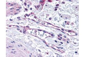 Staining of Vascular Endothelium 40X in human lung using EGLN1 polyclonal antibody . (EGLN1 anticorps)