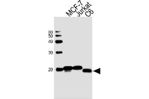 Sample Tissue/Cells lysates probed with antibodyname Monoclonal Antibody, unconjugated (bsm-51413M) at 1:1000 overnight at 4°C followed by a conjugated secondary antibody for 60 minutes at Room Temperature. (NME1 anticorps)