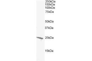 Image no. 1 for anti-BCL2-Antagonist/killer 1 (BAK1) (N-Term) antibody (ABIN374174) (BAK1 anticorps  (N-Term))