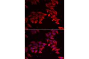 Immunofluorescence analysis of HeLa cell using SFRP4 antibody. (SFRP4 anticorps)