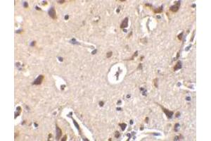 Immunohistochemistry of ILPIP in human brain tissue with ILPIP antibody at 10 μg/ml.