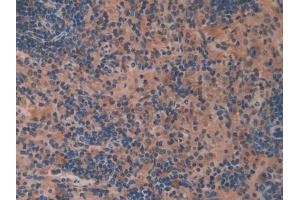 anti-Oncoprotein Induced Transcript 3 (OIT3) (AA 251-524) antibody