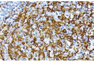 Immunohistochemistry of paraffin-embedded Human tonsil using CSNK1A1 Polyclonal Antibody at dilution of 1:100 (40x lens).