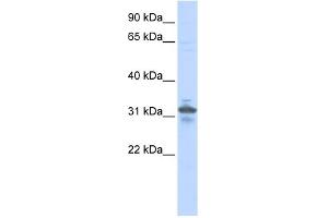 WB Suggested Anti-RPIA Antibody Titration: 0. (Ribose 5-Phosphate Isomerase A (RPIA) (N-Term) anticorps)