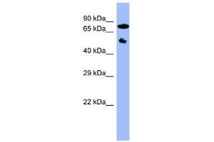 WB Suggested Anti-CYP11B2 Antibody Titration:  0. (CYP11B2 anticorps  (Middle Region))