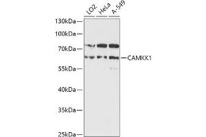 Western blot analysis of extracts of various cell lines, using C antibody (ABIN7266022) at 1:1000 dilution. (CAMKK1 anticorps  (AA 399-520))