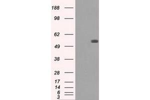 Image no. 2 for anti-Fumarate Hydratase (FH) antibody (ABIN1498269) (FH anticorps)