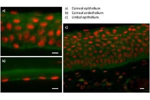 Sample Type :  Eye tissue (ZEB1 anticorps  (N-Term))