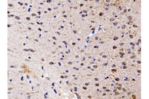 IHC analysis of FKBP135/FKBP15 using anti-FKBP135/FKBP15 antibody (ABIN7600397).