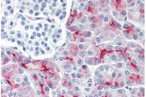 Human Pancreas (formalin-fixed, paraffin-embedded) stained with MUC1 antibody ABIN334252 at 1:50 followed by biotinylated anti-mouse IgG secondary antibody ABIN481714, alkaline phosphatase-streptavidin and chromogen.