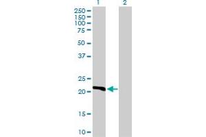 Western Blot analysis of DHFR expression in transfected 293T cell line by DHFR MaxPab polyclonal antibody. (Dihydrofolate Reductase anticorps  (AA 1-187))