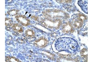 CDK7 antibody was used for immunohistochemistry at a concentration of 4-8 ug/ml to stain Epithelial cells of renal tubule (lndicated with Arrows] in Human Kidney.