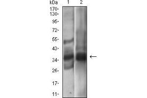 Western blot analysis using EPCAM mouse mAb against A431 (1), MCF-7 (2) cell lysate. (EpCAM anticorps  (AA 24-265))