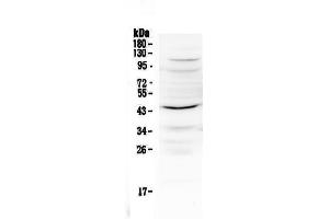 Western blot analysis of IL12B using anti-IL12B antibody . (IL12B anticorps  (AA 23-250))