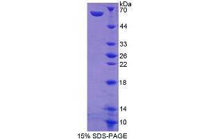 Image no. 1 for Amphiregulin (AREG) (AA 27-247) protein (His tag,GST tag) (ABIN3209856)