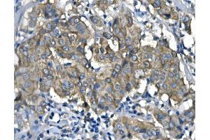 IHC analysis of RENT1/hUPF1 using anti-RENT1/hUPF1 antibody (ABIN7602979).