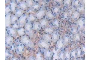 Detection of ALB in Mouse Kidney Tissue using Polyclonal Antibody to Albumin (ALB)