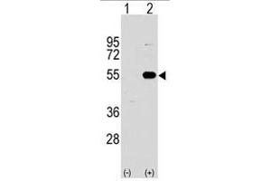 Image no. 2 for anti-Sprouty-Related, EVH1 Domain Containing 1 (SPRED1) (N-Term) antibody (ABIN356947) (SPRED1 anticorps  (N-Term))