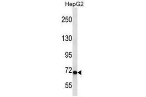 CHD1L Antibody (Center) western blot analysis in HepG2 cell line lysates (35µg/lane). (CHD1L anticorps  (Middle Region))