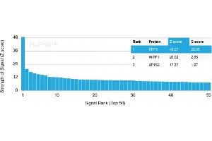 Analysis of Protein Array containing more than 19,000 full-length human proteins using Cytokeratin 5 Mouse Monoclonal Antibody (KRT5/3594).