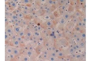 Detection of AZU in Human Liver Tissue using Polyclonal Antibody to Azurocidin (AZU)