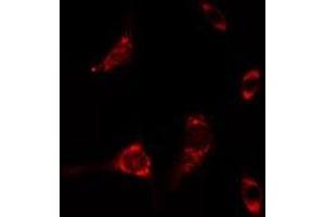 ABIN6275471 staining A549 cells by IF/ICC. (RAB6A anticorps  (Internal Region))