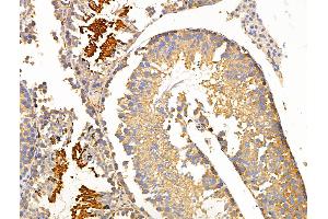 ABIN6264142 and ABIN6266623 at 1/100 staining Mouse testis tissue by IHC-P.