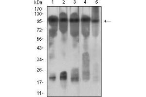 Western blot analysis using CD131 mouse mAb against NIH/3T3 (1), Hela (2), C6 (3) and MCF-7 (4) cell lysate.
