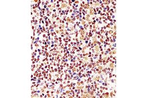 Antibody staining Cyclin D1 in human tonsil tissue sections by Immunohistochemistry (IHC-P - paraformaldehyde-fixed, paraffin-embedded sections). (Cyclin D1 anticorps  (AA 68-97))