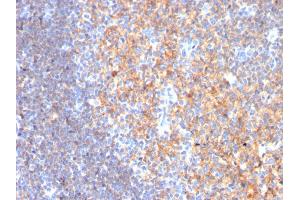 Formalin-fixed, paraffin-embedded human Tonsil stained with CD19 Monospecific Mouse Monoclonal Antibody (CD19/3116).