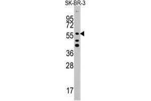 Western blot analysis of ALDH5A1 polyclonal antibody  in SK-BR-3 cell line lysates (35 ug/lane).