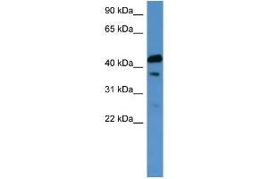 WB Suggested Anti-CALCR Antibody Titration: 0. (Calcitonin Receptor anticorps  (C-Term))