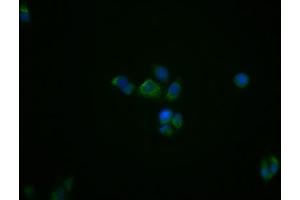 Immunofluorescence staining of PC3 cells with ABIN7127858 at 1:39, counter-stained with DAPI.