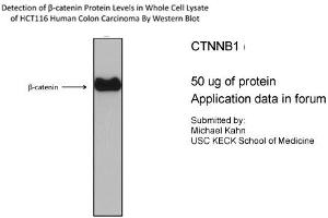 CTNNB1 antibody - N-terminal region (P100600_T100) validated by WB using HCT116 cell lysate CTNNB1 is supported by BioGPS gene expression data to be expressed in HCT116 (CTNNB1 anticorps  (N-Term))