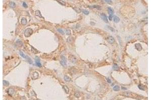 Immunohistochemical staining of formalin-fixed paraffin-embedded rat kidney tissue with PLXNB1 polyclonal antibody  at 1 : 100 dilution. (PLXNB1 anticorps  (N-Term))